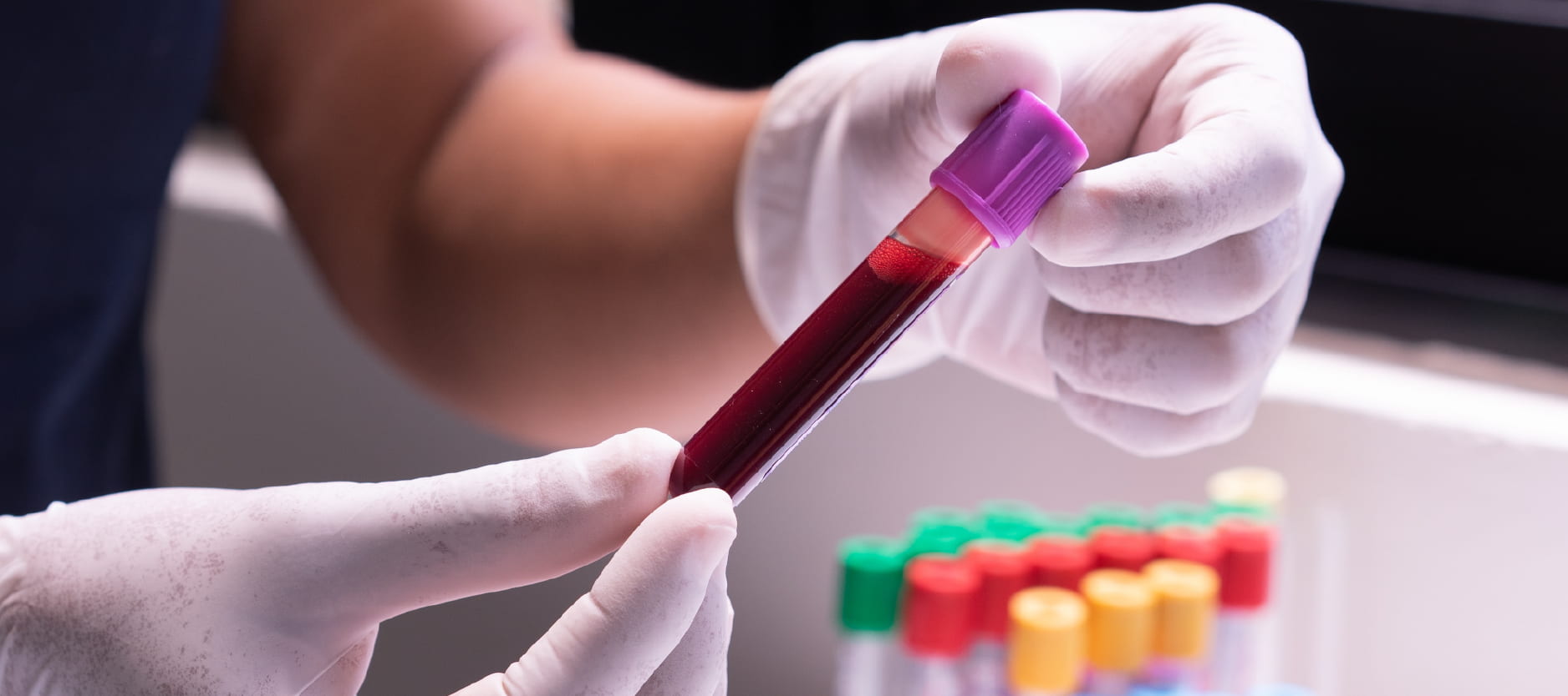 Basic Protocol For Blood Centrifugation