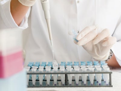 THE BASICS OF RNA ISOLATION