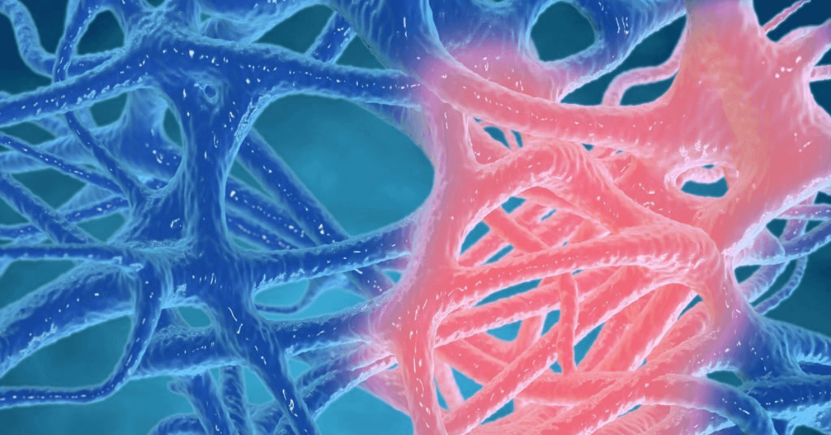 All You Need To Know About Bioadhesion, Bioadhesives, And Their Applications