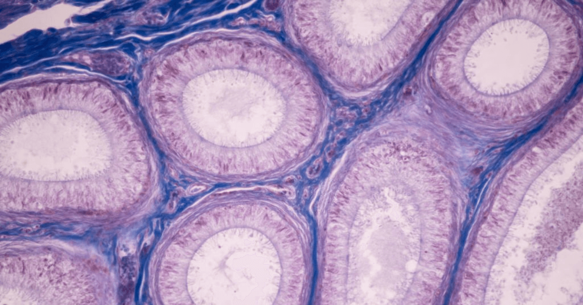 How Cryopreservation Successfully Delivers Cell-Based Therapies