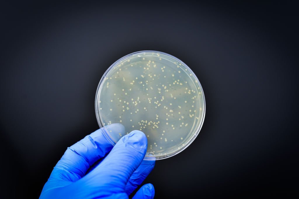 All You Need To Know About Gram Staining 