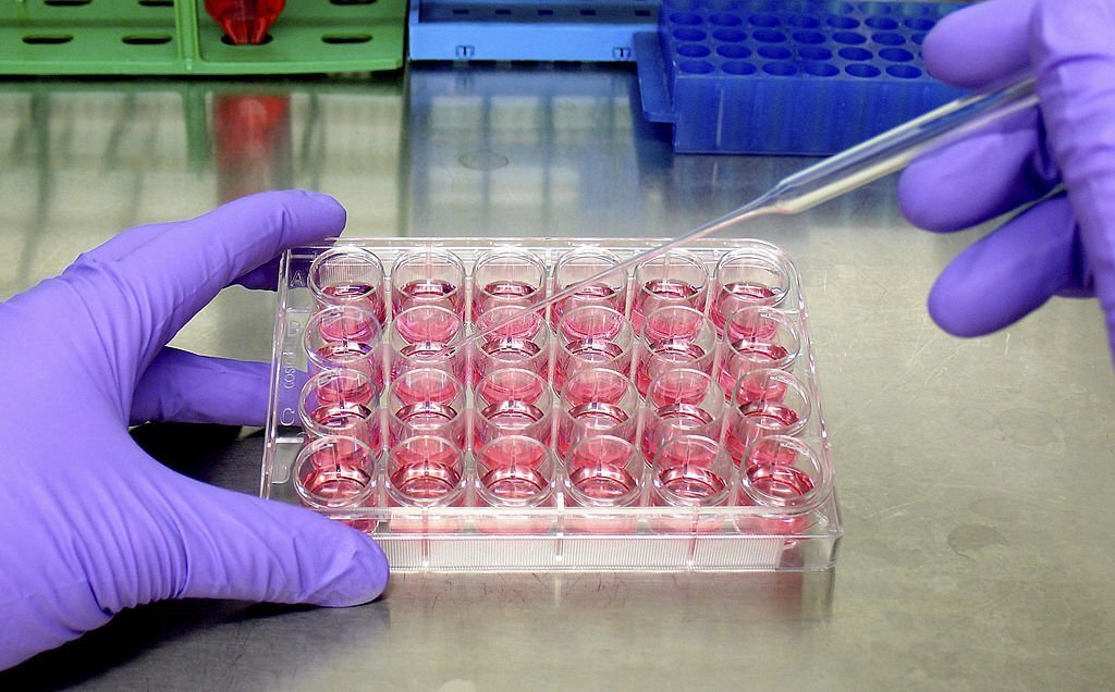4 Neurodegenerative Disease Mechanisms Discovered By Experiments On Yeast