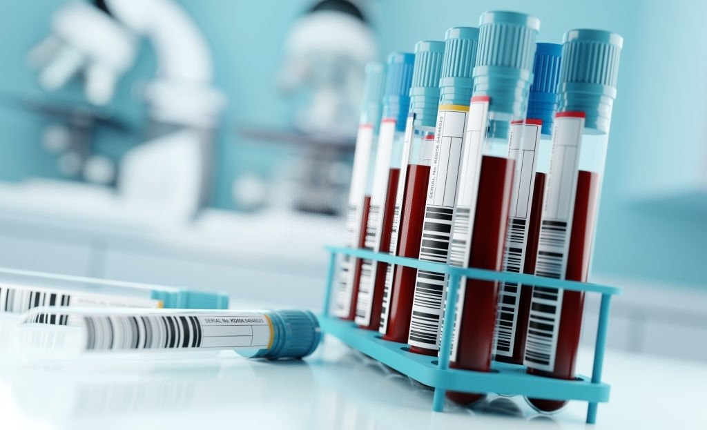 HIV and the battle against it: Here’s how MBP is dedicated to supporting research to find solutions against the Global epidemic of HIV