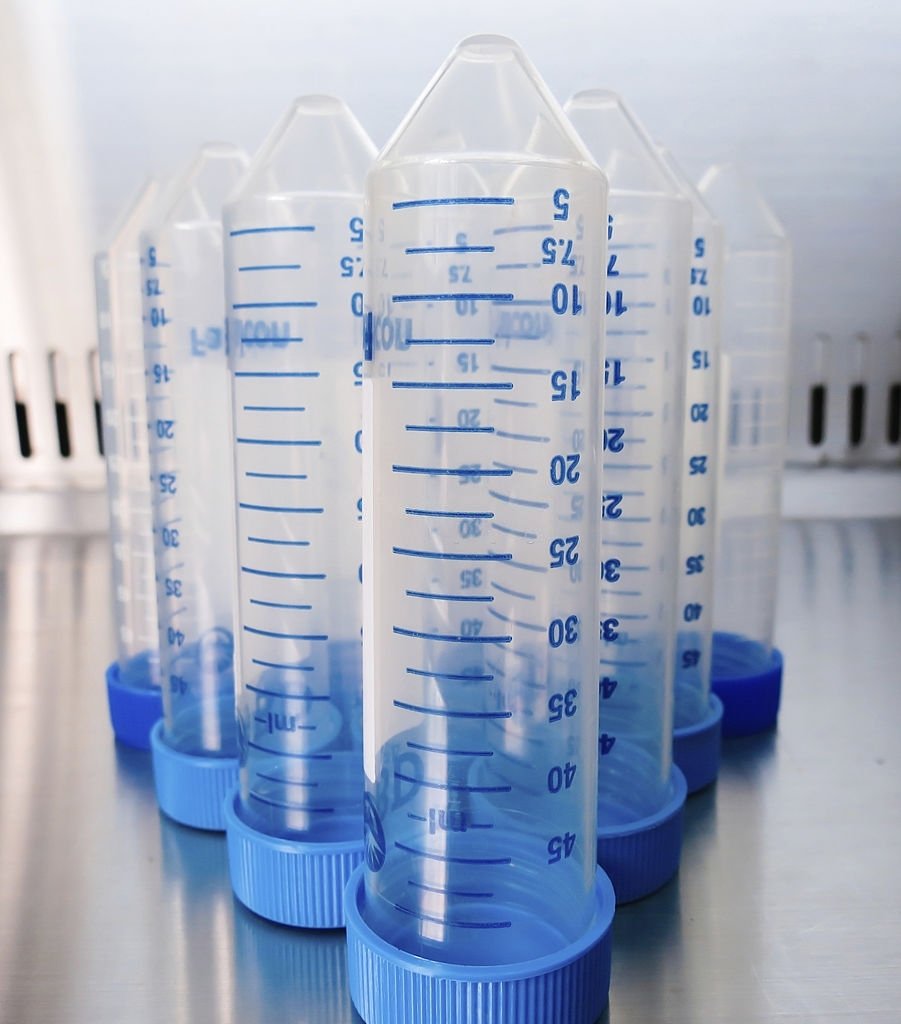 Top Uses Of Centrifuge