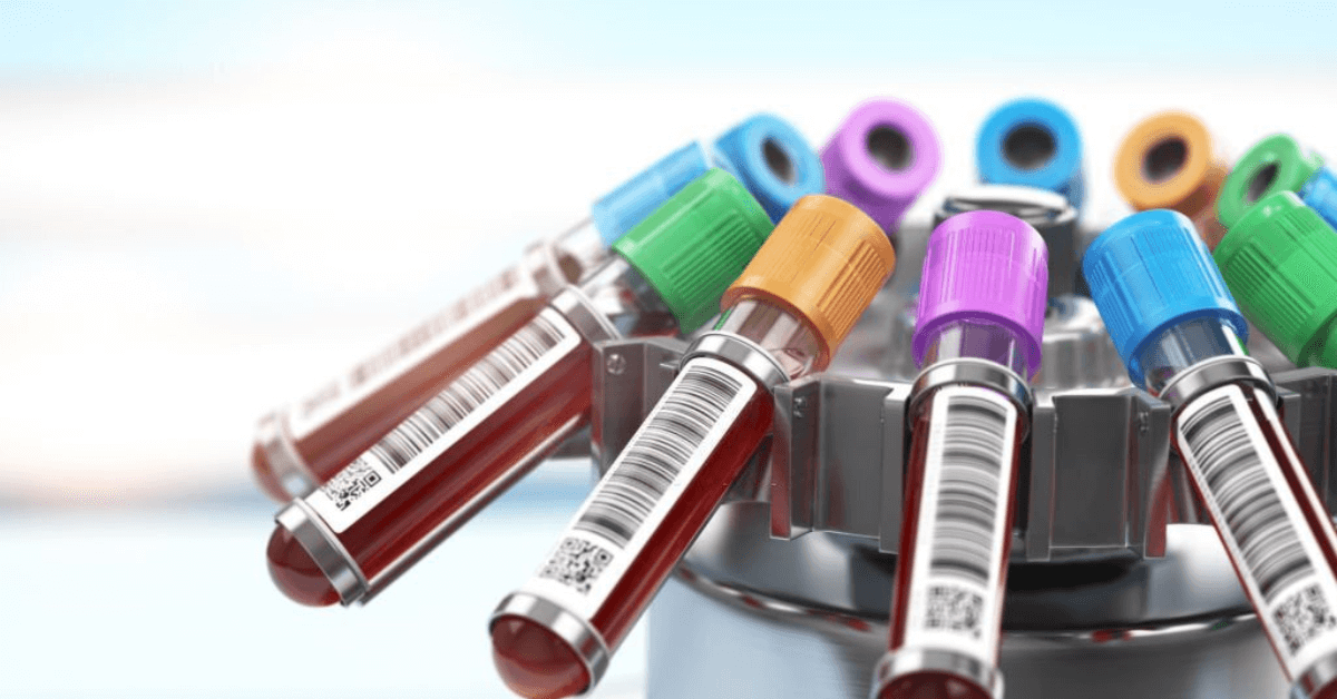 Laboratory Centrifuge: Types, Benefits, And Applications