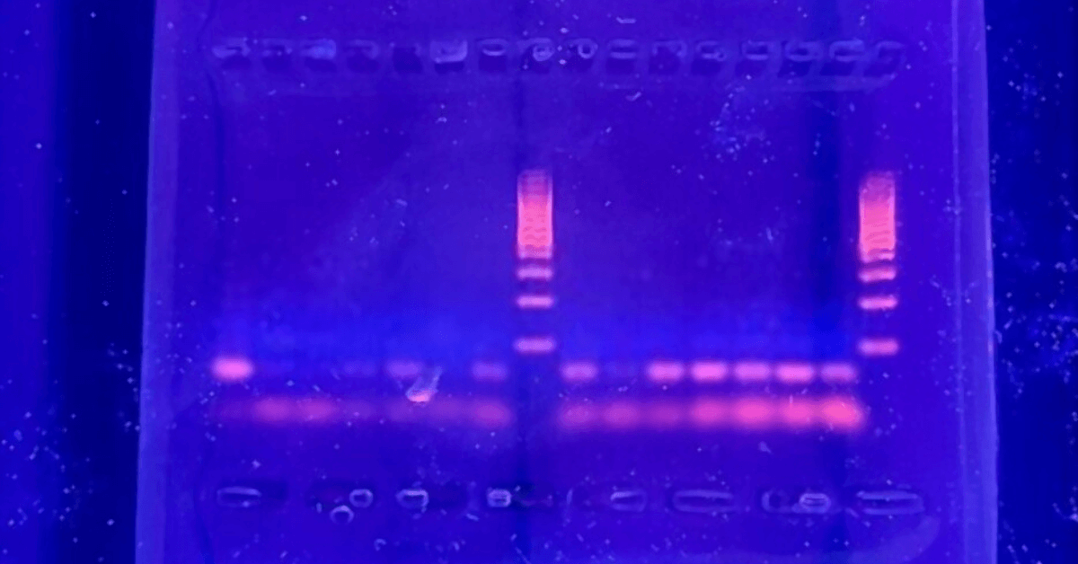 Significance of Transilluminators in Laboratory