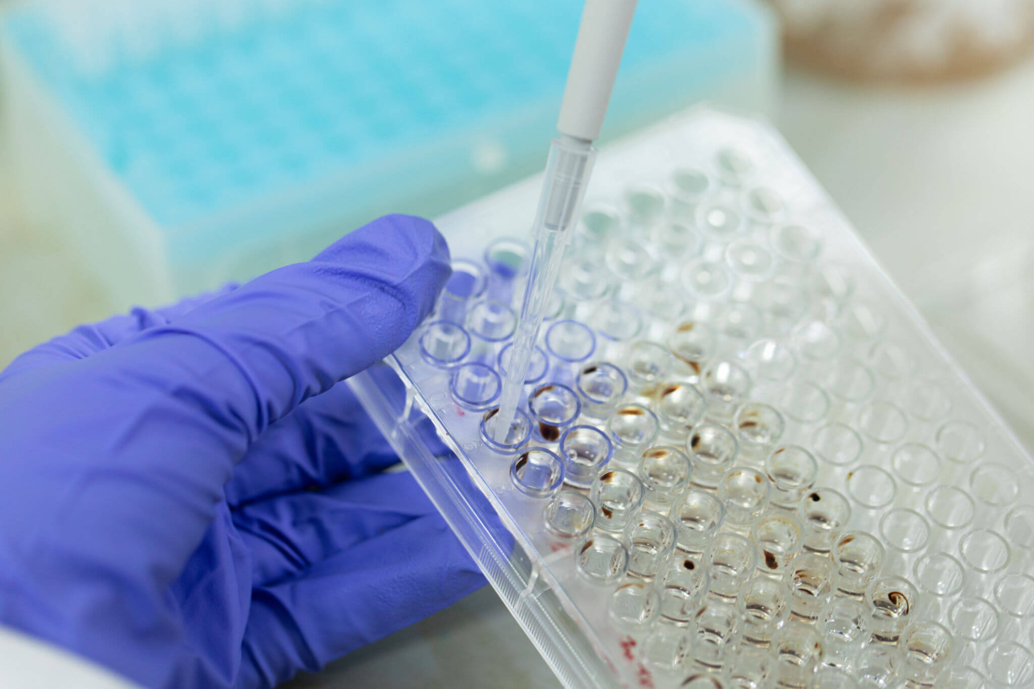 The Types Of Pipette Tips And Their Applications