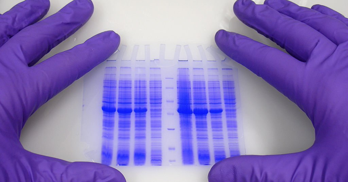 What You Need To Know About Gel Electrophoresis