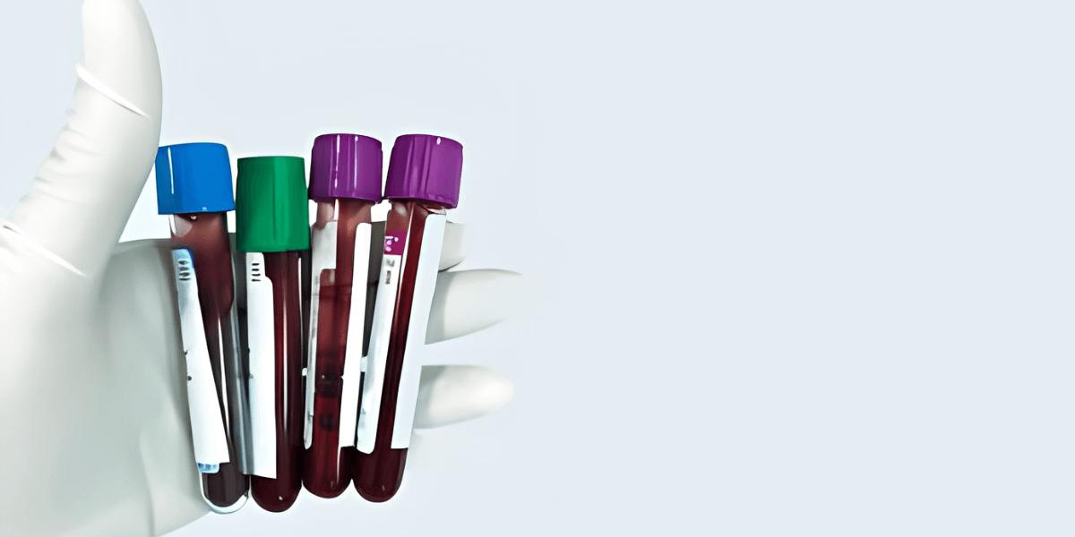 What Are The Benefits Of Using Vacuum Blood Collection Tubes