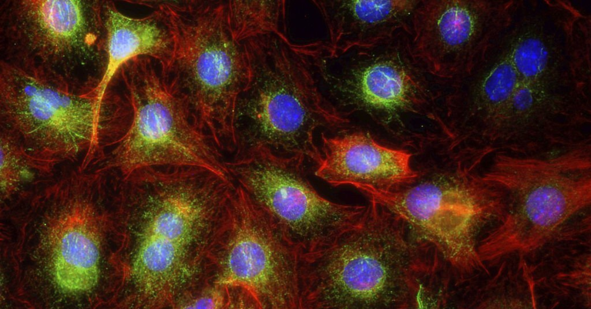 What Are The Characteristics Of Immortalized Cell Lines?