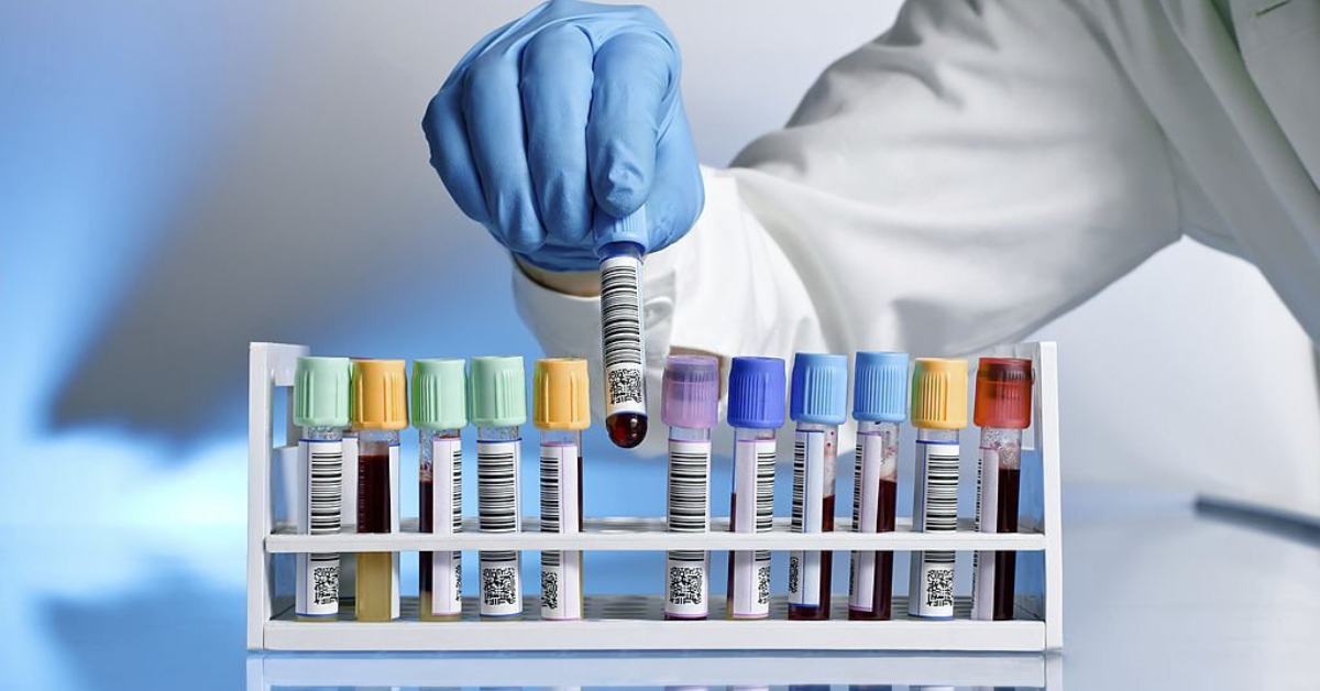 Why Do Your Lab Samples Get Contaminated?