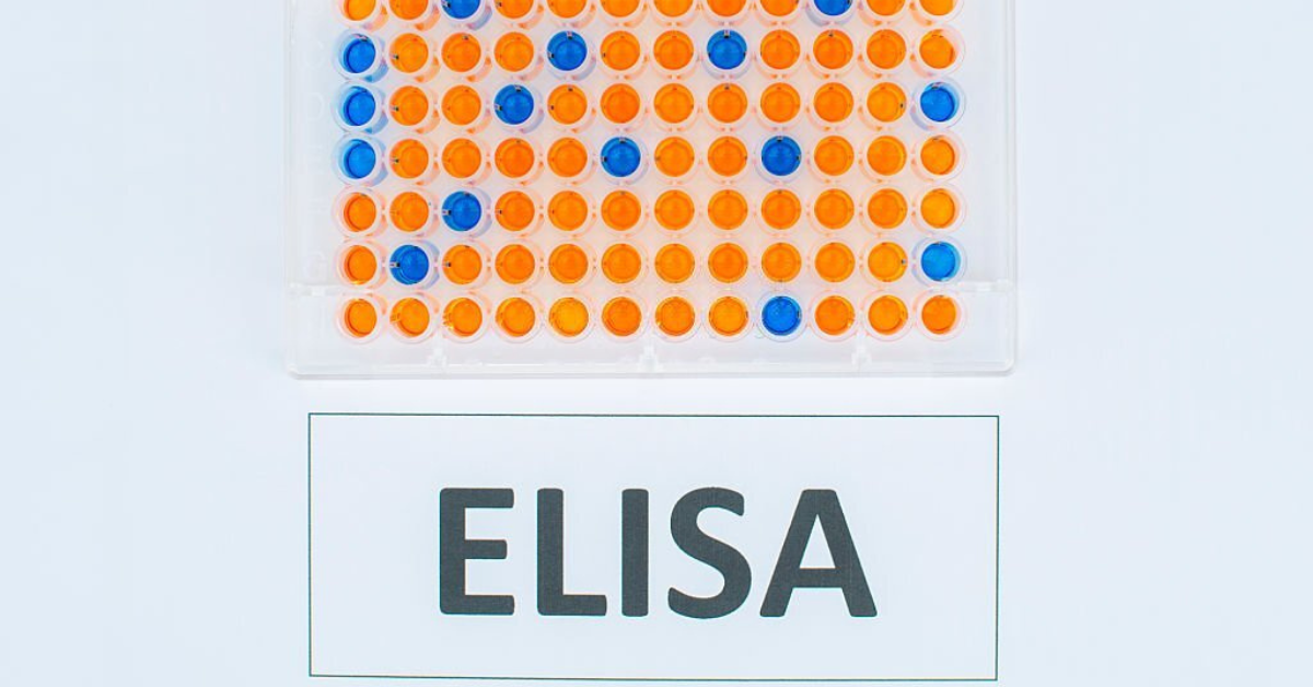 Common Challenges Faced During ELISA