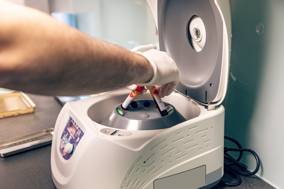 Importance of Quality Microcentrifuge Tubes in Sample Handling